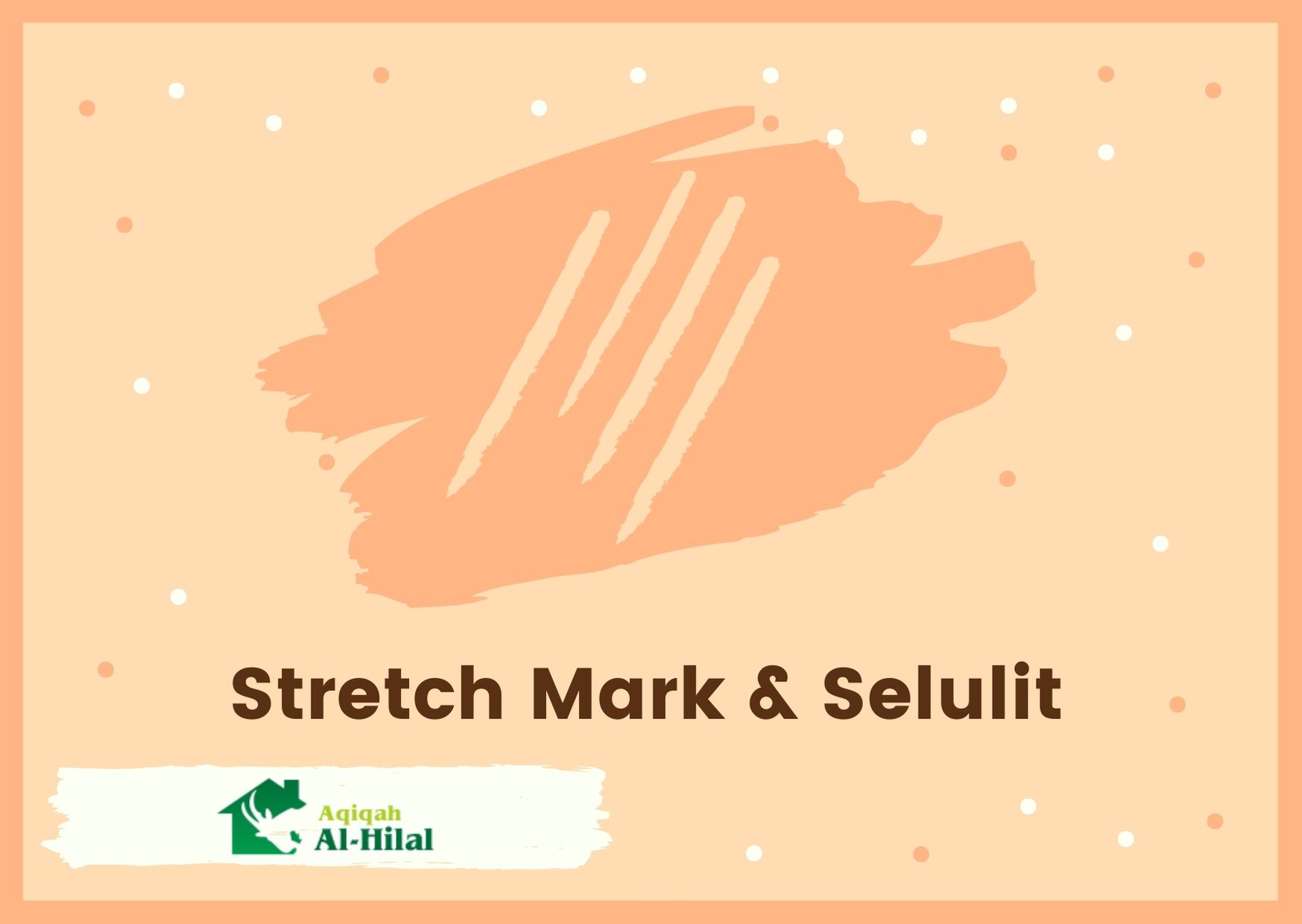 perbedaan strech mark dan selulit